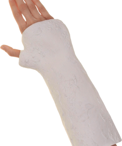 Broken Arm Cast Accessory
